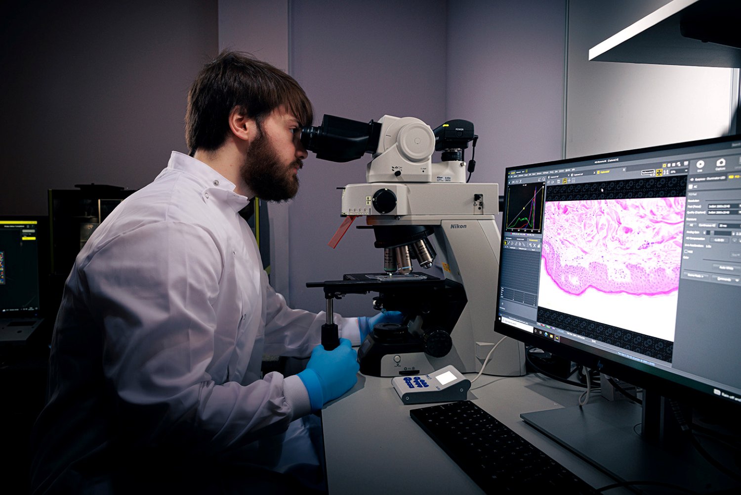 New wound research to tackle pain and cost of chronic wounds – UKRI